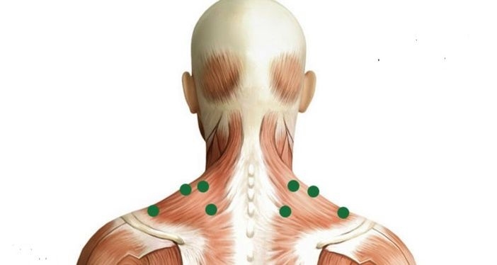 Miyofasyal Gevşetme